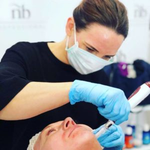 Micro-Needling at Beauty 154 in Lancaster, Lancashire